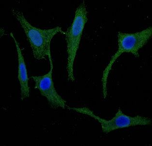 Immunofluorescent analysis of Hela cells using SCGN Antibody at dilution of 1:100 and Alexa Fluor 488-congugated AffiniPure Goat Anti-Rabbit IgG(H+L)Rabbit anti-Human SCGN Polyclonal Antibody