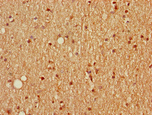 Immunohistochemistry of paraffin-embedded human brain tissue using SCGN Antibody at dilution of 1:100Rabbit anti-Human SCGN Polyclonal Antibody