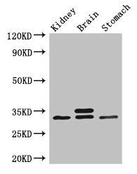 Western Blot  | Positive WB detected in: Mouse kidney tissue, Mouse brain tissue, Mouse stomach tissue  | All lanes: SCGN antibody at 3µg/ml  | Secondary  | Goat polyclonal to rabbit IgG at 1/50000 dilution  | Predicted band size: 33 kDa  | Observed band size: 33 kDaRabbit anti-Human SCGN Polyclonal Antibody
