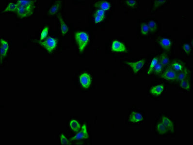 Immunofluorescence staining of HepG2 cells with the antibody at 1:266, counter-stained with DAPI. The cells were fixed in 4% formaldehyde, permeabilized using 0.2% Triton X-100 and blocked in 10% normal Goat Serum. The cells were then incubated with the antibody overnight at 4°C. The secondary antibody was Alexa Fluor 488-congugated AffiniPure Goat Anti-Rabbit IgG(H+L).Rabbit anti-Human SCOC Polyclonal Antibody