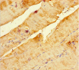 Immunohistochemistry of paraffin-embedded human skeletal muscle tissue using SCOC Antibody at dilution of 1:100Rabbit anti-Human SCOC Polyclonal Antibody