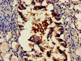 Immunohistochemistry of paraffin-embedded human lung tissue using SCTR Antibody at dilution of 1:100Rabbit anti-Human SCTR Polyclonal Antibody
