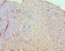 Immunohistochemistry of paraffin-embedded human tonsil tissue using the antibody at dilution of 1:100Rabbit anti-Human SDC1 Polyclonal Antibody