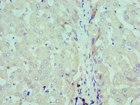 Immunohistochemistry of paraffin-embedded human liver tissue using SDC1 Antibody at dilution of 1:100Rabbit anti-Human SDC1 Polyclonal Antibody