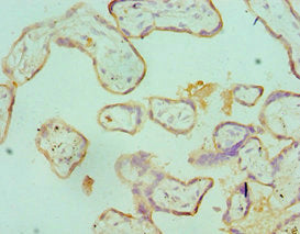 Immunohistochemistry of paraffin-embedded human placenta tissue using SDC1 Antibody at dilution of 1:100Rabbit anti-Human SDC1 Polyclonal Antibody