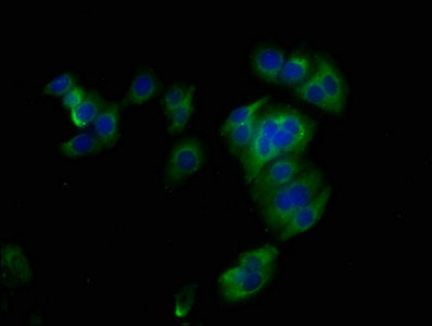 Immunofluorescence staining of HepG2 cells with SDC1 Antibody at 1:400, counter-stained with DAPI. The cells were fixed in 4% formaldehyde, permeabilized using 0.2% Triton X-100 and blocked in 10% normal Goat Serum. The cells were then incubated with the antibody overnight at 4°C. The secondary antibody was Alexa Fluor 488-congugated AffiniPure Goat Anti-Rabbit IgG(H+L).Rabbit anti-Human SDC1 Polyclonal Antibody