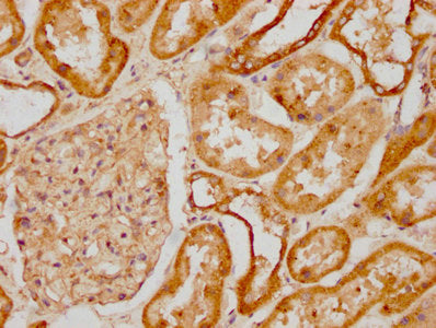 IHC image of the antibody diluted at 1:1200 and staining in paraffin-embedded human kidney tissue performed on a Leica BondTM system. After dewaxing and hydration, antigen retrieval was mediated by high pressure in a citrate buffer (pH 6.0). Section was blocked with 10% normal goat serum 30min at RT. Then primary antibody (1% BSA) was incubated at 4°C overnight. The primary is detected by a biotinylated secondary antibody and visualized using an HRP conjugated SP system.Rabbit anti-Human SDC1 Polyclonal Antibody