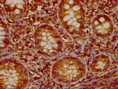 IHC image of SDC1 Antibody diluted at 1:1200 and staining in paraffin-embedded human appendix tissue performed on a Leica BondTM system. After dewaxing and hydration, antigen retrieval was mediated by high pressure in a citrate buffer (pH 6.0). Section was blocked with 10% normal goat serum 30min at RT. Then primary antibody (1% BSA) was incubated at 4°C overnight. The primary is detected by a biotinylated secondary antibody and visualized using an HRP conjugated SP system.Rabbit anti-Human SDC1 Polyclonal Antibody