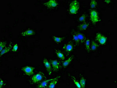 Immunofluorescent analysis of HepG2 cells using SDCBP Antibody at dilution of 1:100 and Alexa Fluor 488-congugated AffiniPure Goat Anti-Rabbit IgG(H+L)Rabbit anti-Human SDCBP Polyclonal Antibody