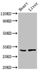 Western Blot | Positive WB detected in: Mouse heart tissue, Rat liver tissue | All lanes: SDCBP antibody at 3μg/ml | Secondary | Goat polyclonal to rabbit IgG at 1/50000 dilution | Predicted band size: 33, 32 kDa | Observed band size: 33 kDaRabbit anti-Human SDCBP Polyclonal Antibody