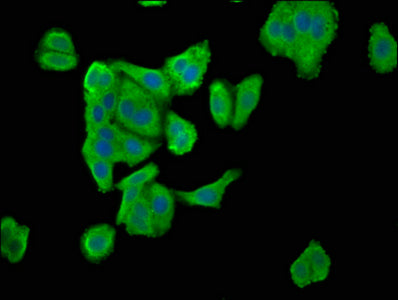 Immunofluorescence staining of HepG2 cells with ENTR1 Antibody at 1:100, counter-stained with DAPI. The cells were fixed in 4% formaldehyde, permeabilized using 0.2% Triton X-100 and blocked in 10% normal Goat Serum. The cells were then incubated with the antibody overnight at 4°C. The secondary antibody was Alexa Fluor 488-congugated AffiniPure Goat Anti-Rabbit IgG(H+L).Rabbit anti-Human ENTR1 Polyclonal Antibody