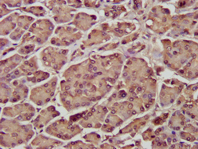 IHC image of the antibody diluted at 1:300 and staining in paraffin-embedded human pancreatic tissue performed on a Leica BondTM system. After dewaxing and hydration, antigen retrieval was mediated by high pressure in a citrate buffer (pH 6.0). Section was blocked with 10% normal goat serum 30min at RT. Then primary antibody (1% BSA) was incubated at 4°C overnight. The primary is detected by a biotinylated secondary antibody and visualized using an HRP conjugated SP system.Rabbit anti-Human ENTR1 Polyclonal Antibody