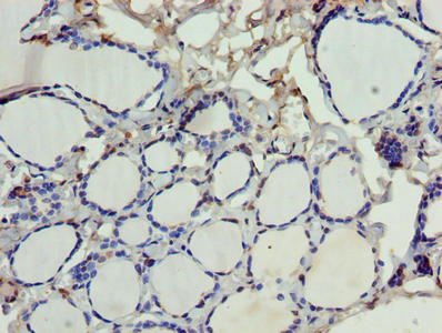 Immunohistochemistry of paraffin-embedded human thyroid tissue using SDSL Antibody at dilution of 1:100Rabbit anti-Human SDSL Polyclonal Antibody