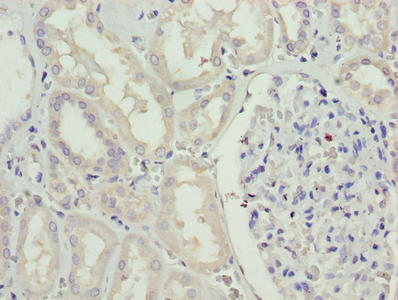 Immunohistochemistry of paraffin-embedded human kidney tissue using SDSL Antibody at dilution of 1:100Rabbit anti-Human SDSL Polyclonal Antibody
