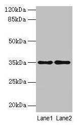 Western blot  | All lanes: SDSL antibody at 4µg/ml  | Lane 1: HepG2 whole cell lysate  | Lane 2: Mouse liver tissue  | Secondary  | Goat polyclonal to rabbit IgG at 1/10000 dilution  | Predicted band size: 35 kDa  | Observed band size: 35 kDaRabbit anti-Human SDSL Polyclonal Antibody
