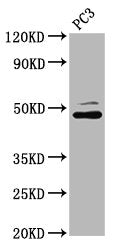 Western Blot  | Positive WB detected in: PC-3 whole cell lysate  | All lanes: SEC14L2 antibody at 4.28µg/ml  | Secondary  | Goat polyclonal to rabbit IgG at 1/50000 dilution  | Predicted band size: 47, 45, 37 kDa  | Observed band size: 47 kDaRabbit anti-Human SEC14L2 Polyclonal Antibody