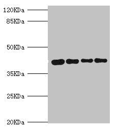 Western blot | All lanes: SEPHS1 antibody at 3.05μg/ml | Lane 1: Mouse liver tissue | Lane 2: HepG2 whole cell lysate | Lane 3: Mouse kidney tissue | Lane 4: U251 whole cell lysate | Secondary | Goat polyclonal to rabbit IgG at 1/10000 dilution | Predicted band size: 43, 36 kDa | Observed band size: 43 kDaRabbit anti-Human SEPHS1 Polyclonal Antibody
