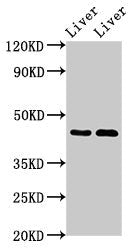 Western Blot  | Positive WB detected in: Rat liver tissue, Mouse liver tissue  | All lanes: SERPINA5 antibody at 3μg/ml  | Secondary  | Goat polyclonal to rabbit IgG at 1/50000 dilution  | Predicted band size: 46 kDa  | Observed band size: 46 kDaRabbit anti-Human SERPINA5 Polyclonal Antibody