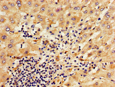 IHC image of SERPINA6 Antibody diluted at 1:800 and staining in paraffin-embedded human liver tissue performed on a Leica BondTM system. After dewaxing and hydration, antigen retrieval was mediated by high pressure in a citrate buffer (pH 6.0). Section was blocked with 10% normal goat serum 30min at RT. Then primary antibody (1% BSA) was incubated at 4°C overnight. The primary is detected by a biotinylated secondary antibody and visualized using an HRP conjugated SP system.Rabbit anti-Human SERPINA6 Polyclonal Antibody
