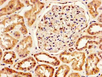 IHC image of SERPINA6 Antibody diluted at 1:800 and staining in paraffin-embedded human kidney tissue performed on a Leica BondTM system. After dewaxing and hydration, antigen retrieval was mediated by high pressure in a citrate buffer (pH 6.0). Section was blocked with 10% normal goat serum 30min at RT. Then primary antibody (1% BSA) was incubated at 4°C overnight. The primary is detected by a biotinylated secondary antibody and visualized using an HRP conjugated SP system.Rabbit anti-Human SERPINA6 Polyclonal Antibody