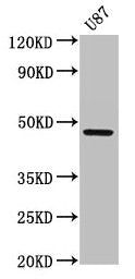 Western Blot  | Positive WB detected in: U87 whole cell lysate  | All lanes: SERPINA6 antibody at 2.7µg/ml  | Secondary  | Goat polyclonal to rabbit IgG at 1/50000 dilution  | Predicted band size: 46 kDa  | Observed band size: 46 kDaRabbit anti-Human SERPINA6 Polyclonal Antibody