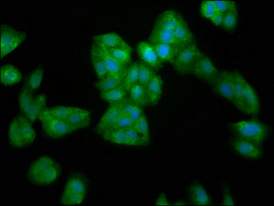 Immunofluorescence staining of HepG2 cells with SERPINB4 Antibody at 1:200, counter-stained with DAPI. The cells were fixed in 4% formaldehyde, permeabilized using 0.2% Triton X-100 and blocked in 10% normal Goat Serum. The cells were then incubated with the antibody overnight at 4°C. The secondary antibody was Alexa Fluor 488-congugated AffiniPure Goat Anti-Rabbit IgG(H+L).Rabbit anti-Human SERPINB4 Polyclonal Antibody