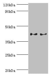 Western blot | All lanes: Serpin B5 antibody at 2μg/ml | Lane 1: HepG2 whole cell lysate | Lane 2: A431 whole cell lysate | Secondary | Goat polyclonal to rabbit IgG at 1/10000 dilution | Predicted band size: 43, 26 kDa | Observed band size: 43 kDaRabbit anti-Human SERPINB5 Polyclonal Antibody