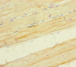 Immunohistochemistry of paraffin-embedded human skeletal muscle tissue using SERPINB6 Antibody at dilution of 1:100Rabbit anti-Human SERPINB6 Polyclonal Antibody