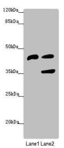 Western blot | All lanes: SERPINB6 antibody at 0.95 μg/ml | Lane 1: Human placenta tissue | Lane 2: HepG2 whole cell lysate | Secondary | Goat polyclonal to rabbit IgG at 1/10000 dilution | Predicted band size: 43 kDa | Observed band size: 43, 36 kDaRabbit anti-Human SERPINB6 Polyclonal Antibody