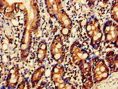 Immunohistochemistry of paraffin-embedded human small intestine tissue using the antibody at dilution of 1:100Rabbit anti-Human SERPINC1 Polyclonal Antibody