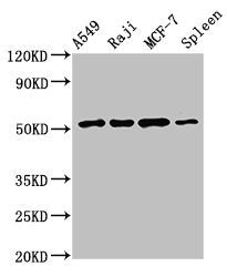 Western Blot | Positive WB detected in: A549 whole cell lysate, Raji whole cell lysate, MCF-7 whole cell lysate, Rat spleen tissue | All lanes: SERPINC1 antibody at 2.5μg/ml | Secondary | Goat polyclonal to rabbit IgG at 1/50000 dilution | Predicted band size: 53 kDa | Observed band size: 53 kDaRabbit anti-Human SERPINC1 Polyclonal Antibody