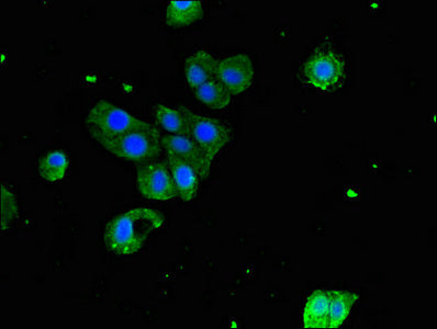 Immunofluorescent analysis of HepG2 cells using SERPING1 Antibody at dilution of 1:100 and Alexa Fluor 488-congugated AffiniPure Goat Anti-Rabbit IgG(H+L)Rabbit anti-Human SERPING1 Polyclonal Antibody