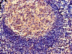 Immunohistochemistry of paraffin-embedded human tonsil tissue using the antibody at dilution of 1:100Rabbit anti-Human SERPING1 Polyclonal Antibody