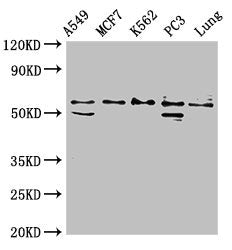 Western Blot | Positive WB detected in: A549 whole cell lysate, MCF-7 whole cell lysate, K562 whole cell lysate, PC-3 whole cell lysate, Rat lung tissue | All lanes: SERPING1 antibody at 2μg/ml | Secondary | Goat polyclonal to rabbit IgG at 1/50000 dilution | Predicted band size: 56, 50 kDa | Observed band size: 56 kDaRabbit anti-Human SERPING1 Polyclonal Antibody