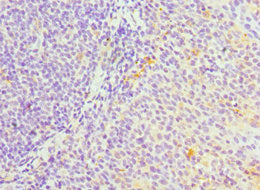 Immunohistochemistry of paraffin-embedded human tonsil tissue using SERPINH1 Antibody at dilution of 1:100