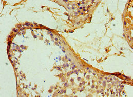 Immunohistochemistry of paraffin-embedded human testis tissue using SERPINH1 Antibody at dilution of 1:100