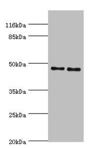 Western blot | All lanes: Serpin H1 antibody at 2μg/ml | Lane 1: NIH/3T3 whole cell lysate | Lane 2: A2780 whole cell lysate | Secondary | Goat polyclonal to rabbit IgG at 1/10000 dilution | Predicted band size: 46 kDa | Observed band size: 46 kDa