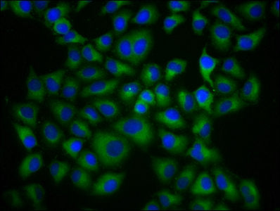 Immunofluorescence staining of Hela cells with HLA-G Antibody at 1:133, counter-stained with DAPI. The cells were fixed in 4% formaldehyde, permeabilized using 0.2% Triton X-100 and blocked in 10% normal Goat Serum. The cells were then incubated with the antibody overnight at 4°C. The secondary antibody was Alexa Fluor 488-congugated AffiniPure Goat Anti-Rabbit IgG(H+L).Rabbit anti-Human HLA-G Polyclonal Antibody