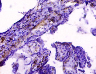 Immunohistochemistry of paraffin-embedded human placenta tissue using the antibody at dilution of 1:50Rabbit anti-Human HLA-G Polyclonal Antibody