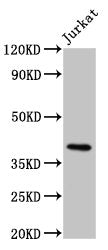 Western Blot  | Positive WB detected in:Jurkat whole cell lysate  | All lanes:HLA-G antibody at 8μg/ml  | Secondary  | Goat polyclonal to rabbit IgG at 1/50000 dilution  | Predicted band size: 39 kDa  | Observed band size: 39 kDaRabbit anti-Human HLA-G Polyclonal Antibody
