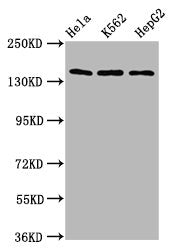 Western Blot  | Positive WB detected in: Hela whole cell lysate, K562 whole cell lysate, HepG2 whole cell lysate  | All lanes: SF3B1 antibody at 9.8µg/ml  | Secondary  | Goat polyclonal to rabbit IgG at 1/50000 dilution  | Predicted band size: 146, 17 kDa  | Observed band size: 146 kDaRabbit anti-Human SF3B1 Polyclonal Antibody