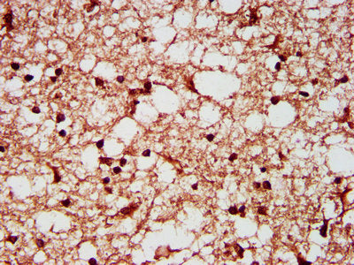 IHC image of SF3B1 Antibody diluted at 1:200 and staining in paraffin-embedded human brain tissue performed on a Leica BondTM system. After dewaxing and hydration, antigen retrieval was mediated by high pressure in a citrate buffer (pH 6.0). Section was blocked with 10% normal goat serum 30min at RT. Then primary antibody (1% BSA) was incubated at 4°C overnight. The primary is detected by a biotinylated secondary antibody and visualized using an HRP conjugated SP system.Rabbit anti-Human SF3B1 Polyclonal Antibody