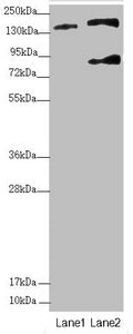 Western blot | All lanes: SFI1 antibody at 2.9 μg/ml | Lane 1: A549 whole cell lysate | Lane 2: HepG2 whole cell lysate | Secondary | Goat polyclonal to rabbit IgG at 1/10000 dilution | Predicted band size: 148, 144, 139, 122, 118, 142, 137 kDa | Observed band size: 148, 85 kDa