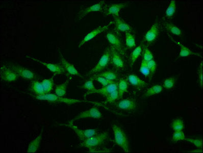 Immunofluorescence staining of Hela cells with SFN Antibody at 1:225, counter-stained with DAPI. The cells were fixed in 4% formaldehyde, permeabilized using 0.2% Triton X-100 and blocked in 10% normal Goat Serum. The cells were then incubated with the antibody overnight at 4°C. The secondary antibody was Alexa Fluor 488-congugated AffiniPure Goat Anti-Rabbit IgG(H+L).Rabbit anti-Human SFN Polyclonal Antibody