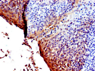 IHC image of SFN Antibody diluted at 1:600 and staining in paraffin-embedded human tonsil tissue performed on a Leica BondTM system. After dewaxing and hydration, antigen retrieval was mediated by high pressure in a citrate buffer (pH 6.0). Section was blocked with 10% normal goat serum 30min at RT. Then primary antibody (1% BSA) was incubated at 4°C overnight. The primary is detected by a biotinylated secondary antibody and visualized using an HRP conjugated SP system.Rabbit anti-Human SFN Polyclonal Antibody
