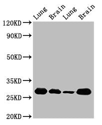 Western Blot | Positive WB detected in: Rat lung tissue, Rat brain tissue, Mouse lung tissue, Mouse brain tissue | All lanes: SFN antibody at 5μg/ml | Secondary | Goat polyclonal to rabbit IgG at 1/50000 dilution | Predicted band size: 28, 25 kDa | Observed band size: 28 kDaRabbit anti-Human SFN Polyclonal Antibody