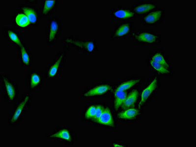 Immunofluorescent analysis of Hela cells using SFRP1 Antibody at dilution of 1:100 and Alexa Fluor 488-congugated AffiniPure Goat Anti-Rabbit IgG(H+L)Rabbit anti-Human SFRP1 Polyclonal Antibody