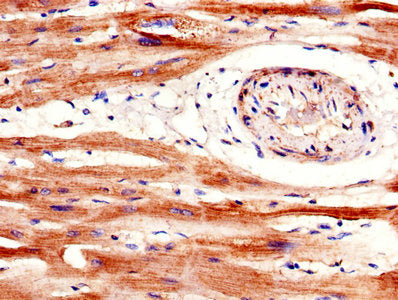 IHC image of SFRP1 Antibody diluted at 1:600 and staining in paraffin-embedded human heart tissue performed on a Leica BondTM system. After dewaxing and hydration, antigen retrieval was mediated by high pressure in a citrate buffer (pH 6.0). Section was blocked with 10% normal goat serum 30min at RT. Then primary antibody (1% BSA) was incubated at 4°C overnight. The primary is detected by a biotinylated secondary antibody and visualized using an HRP conjugated SP system.Rabbit anti-Human SFRP1 Polyclonal Antibody
