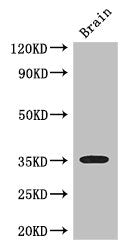 Western Blot | Positive WB detected in: Mouse brain tissue | All lanes: SFRP1 antibody at 3μg/ml | Secondary | Goat polyclonal to rabbit IgG at 1/50000 dilution | Predicted band size: 36 kDa | Observed band size: 36 kDaRabbit anti-Human SFRP1 Polyclonal Antibody