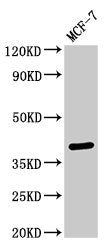 Western Blot | Positive WB detected in: MCF-7 whole cell lysate | All lanes: SFRP4 antibody at 3μg/ml | Secondary | Goat polyclonal to rabbit IgG at 1/50000 dilution | Predicted band size: 40 kDa | Observed band size: 40 kDaRabbit anti-Human SFRP4 Polyclonal Antibody